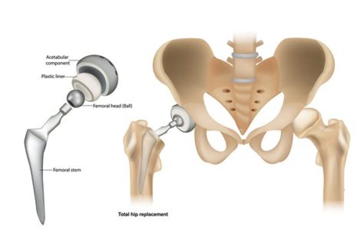 When will op toral end?