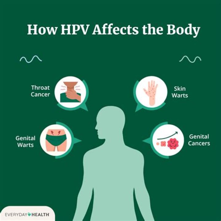 Which hpv causes condyloma?