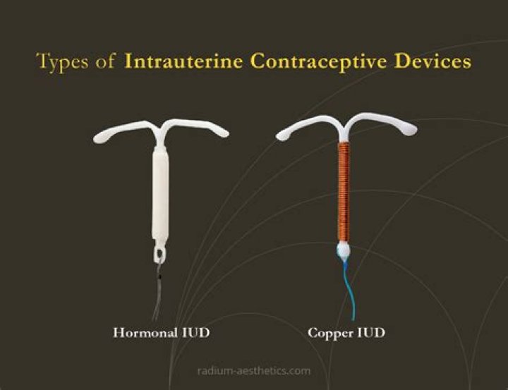 Which iud stops periods?