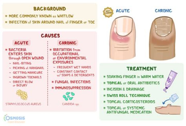 Which of the following commonly causes onychorrhexis?