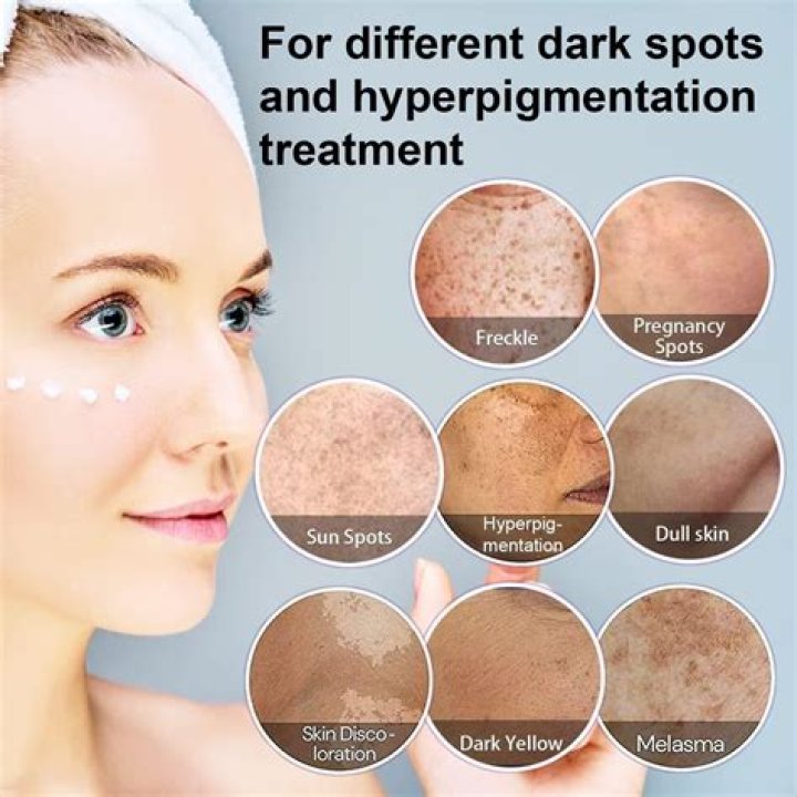 Which oil is best for pigmentation?