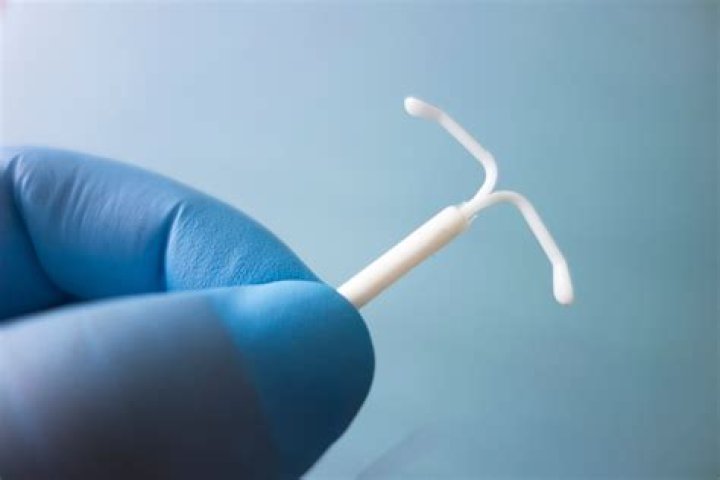 Who can remove iuds?