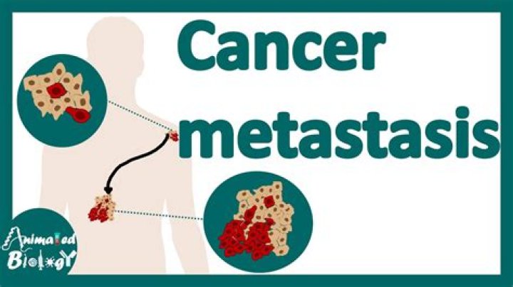 Why does metastasis occur?