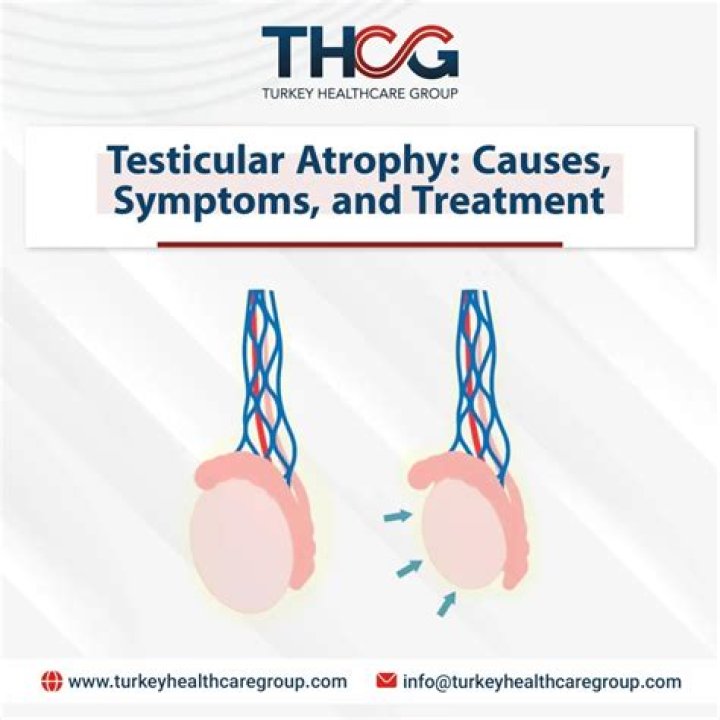 Will hcg reverse testicular atrophy?
