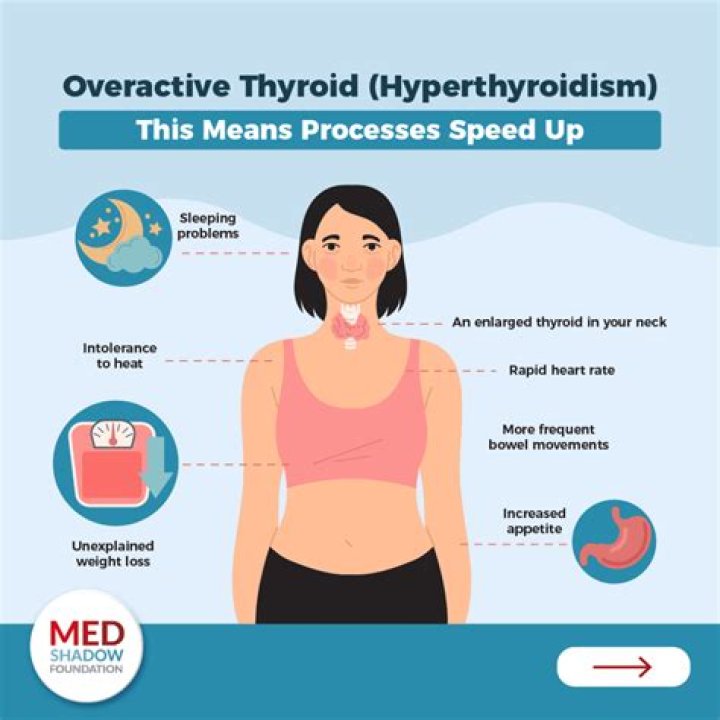 Will hypothyroidism cause weight loss?