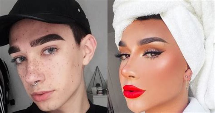 YouTube Star James Charles Reveals What Cosmetic Procedures He’s Had Done: ‘I’m Very Open About It’